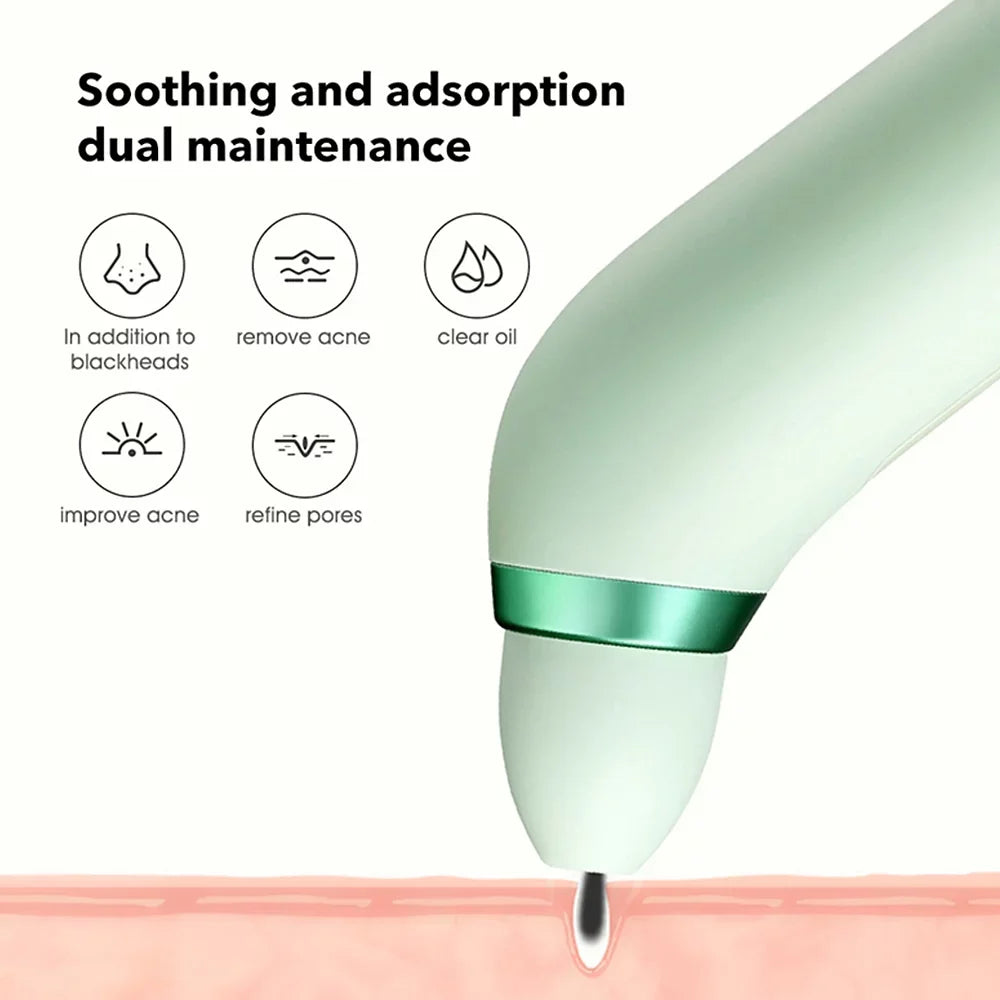 PinJing Vacuum Blackhead Remover